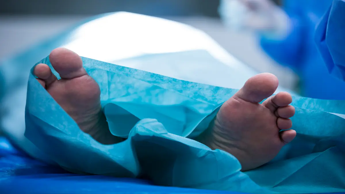 Artroplastia de Keller–Brandes: para quem é e resultados